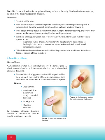 baby circumcision infection